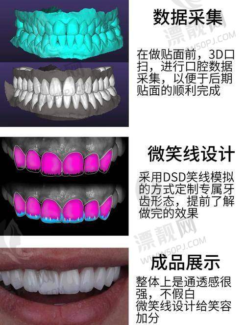 四、南宁柏乐口腔——配备瓷睿刻，追求效率与品质兼得