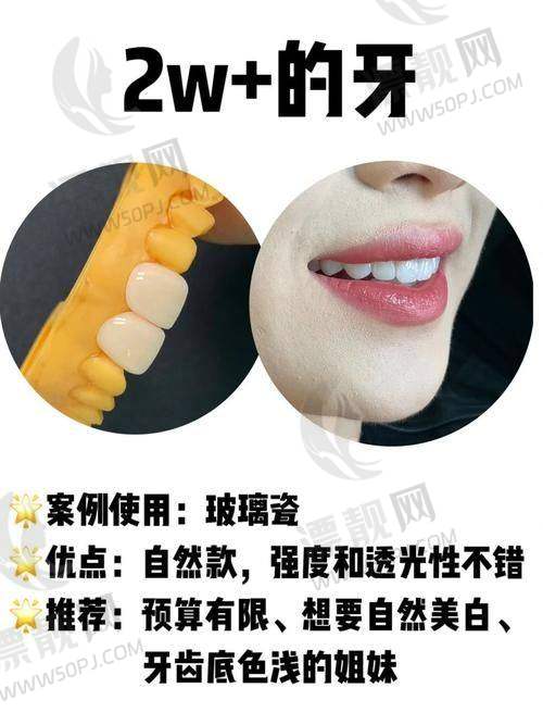 九、南宁市口腔医疗中 心——政府办医院，价格实在