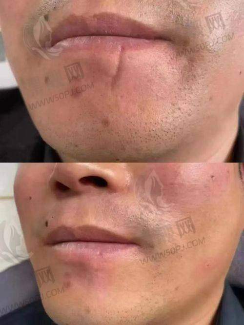 南通椿树上医疗美容