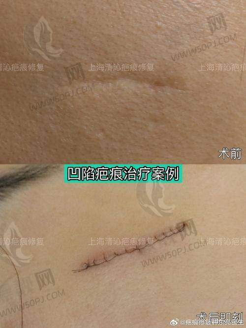 南通去疤痕哪家医院好？南京友谊南通分院等多家医院祛疤特色大比拼