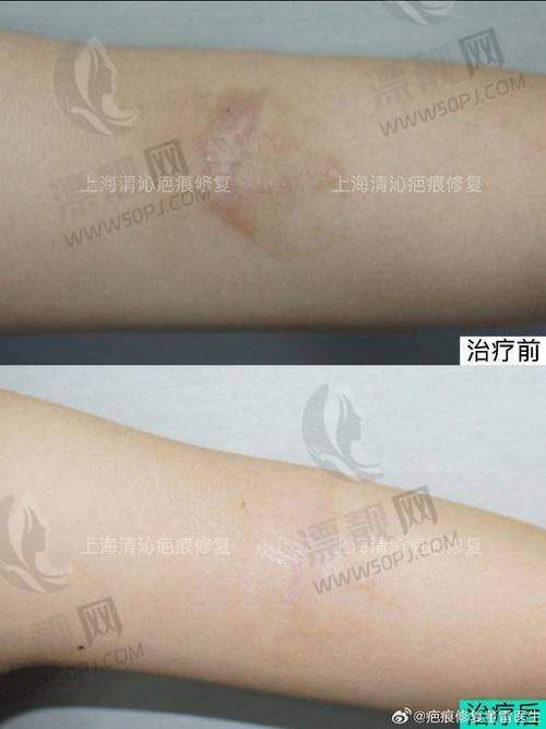 南通华美整形美容医院
