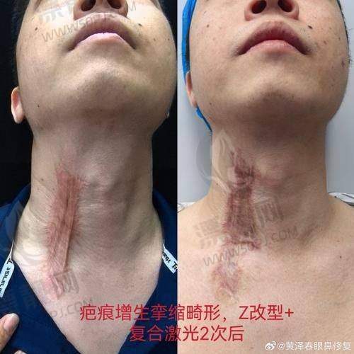 南通伯思立医疗美容