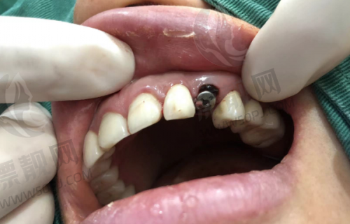 3. 长沙好大夫口腔