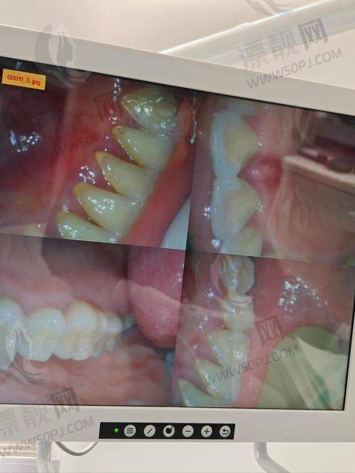 8. 北京瑞泰口腔：连锁+法定二级资质，靠谱又放心
