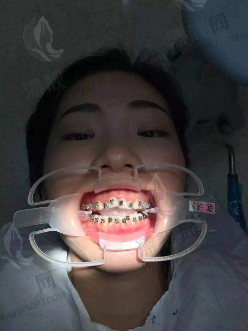 那些“你可能不知道”的口腔优惠补贴