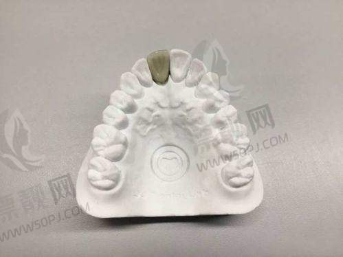 深圳德艺口腔的医生团队如何？这些技术不得不夸