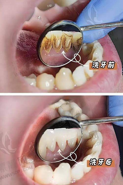 舟山益牙口腔门诊部整体实力如何？从外行到内行皆点赞！