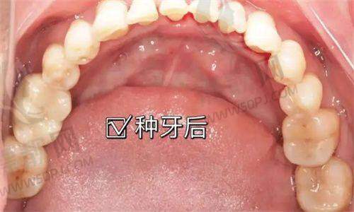 拿得出手的特色项目，在当地真有那么“香”？