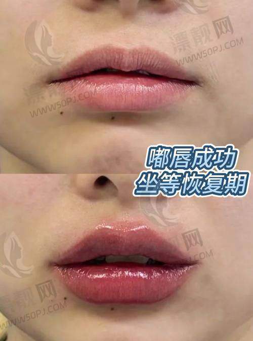 一、深圳福雅医疗美容医院正规吗？深度扒一扒资质到底靠不靠谱