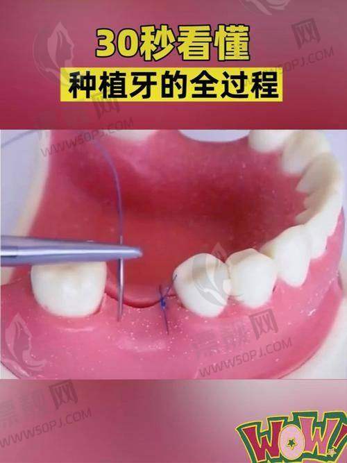 六、结语总结——好牙口腔，牙靠谱、价给力、人也靠谱！