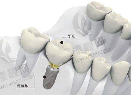 8. 邓建高口腔诊所——老品牌信赖，牙病治疗稳当