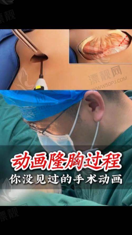 重庆西 南医院隆鼻价格表曝光！一句话总结：用材料决定预算，上限随追求！