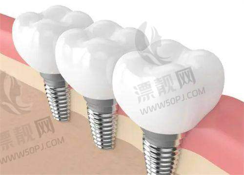 6. 金铂利口腔：价格透明，实惠路线性价比高