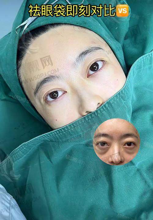 七、结语：第一次找健丽？这篇文章替你少走一周路！