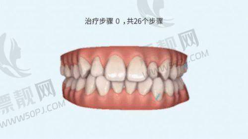 7. 上海雅悦口腔 —— 种植实力稳居，半口修复热门