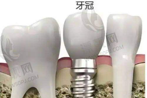 四、收费贵不贵？我们拿实打实价目表跟你掰扯清楚