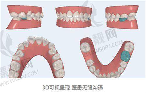 四、网友提问：朝阳区种牙为什么这么多便宜医院？靠谱吗？