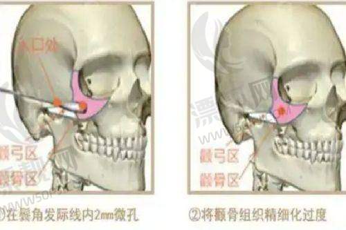 上海艺星医疗美容医院