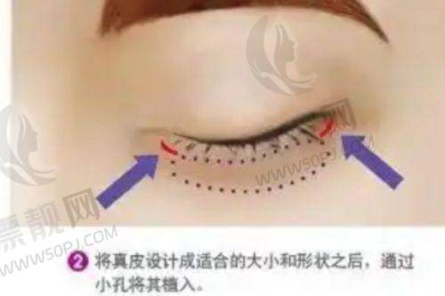 上海九院整复外科