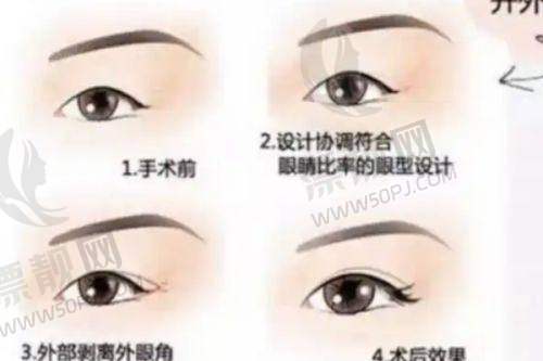 上海艺星医疗美容医院:许炎龙医生的美丽魔法海内外