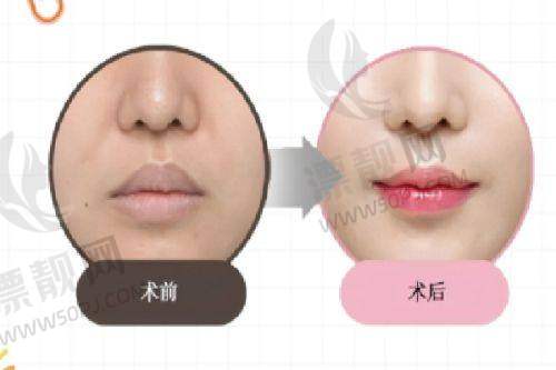 上海薇琳医疗美容医院