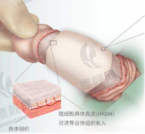 上海市医美医院最好的医院是哪家？揭秘上海医美医院排名前三的实力机构！