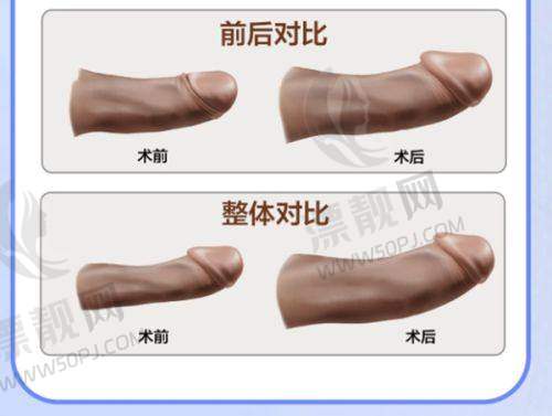 上海时光整形外科医院——何晋龙医生操刀