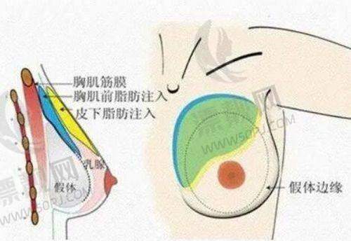 北京加减美医疗美容v6/v9技术优势全解析