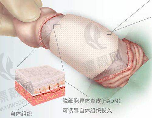 上海美莱医疗美容医院