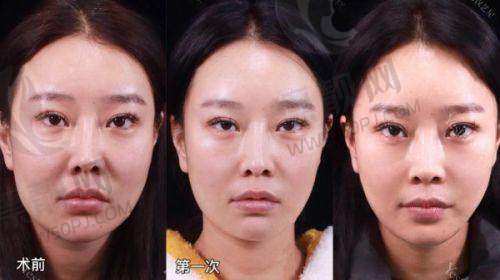 上海美立方医疗美容医院——赵翊利医生助力