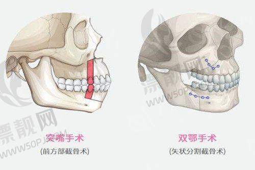 上海伊莱美医疗美容医院:邱文苑医生的面部魔法