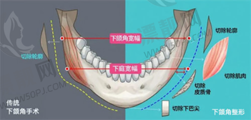 北京加减美医疗美容美容 V6 价格大剖析