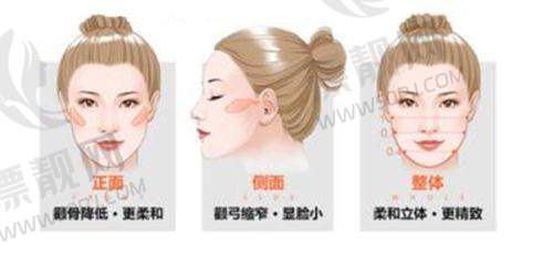 上海愉悦美联臣医疗美容医院——医生曹栋弼等