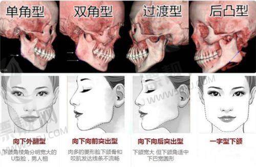 上海九院整复外科