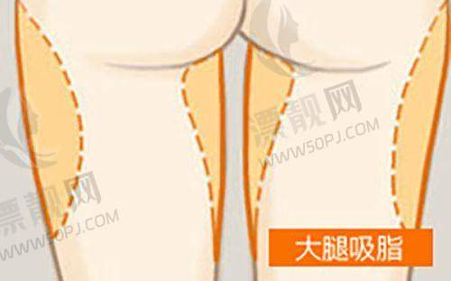 北京加减美医疗美容抖音团购费用情况