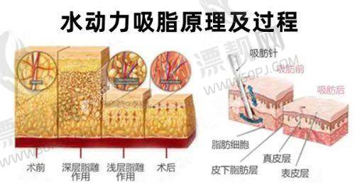上海市做医美十大医院2025榜单更新！揭秘上海出名医美机构的热门项目与优惠活动