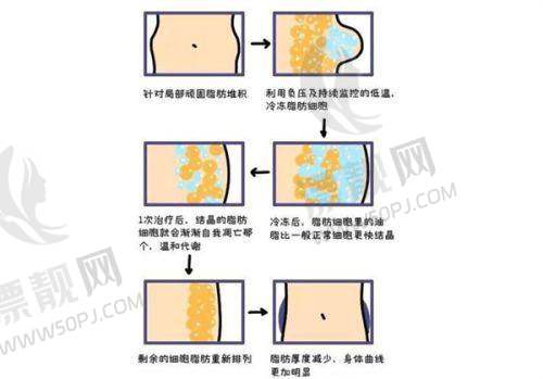 上海伊莱美医疗美容医院——医生李湘原等