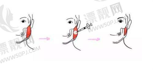 上海愉悦美联臣医疗美容医院