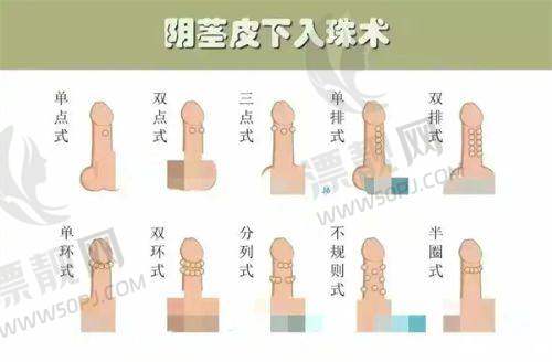 上海九院整复外科——韦敏医生助力