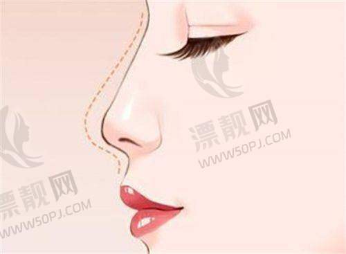上海市医美哪家好？揭秘上海医美医院排名前十，探寻出名医美品牌的魅力！