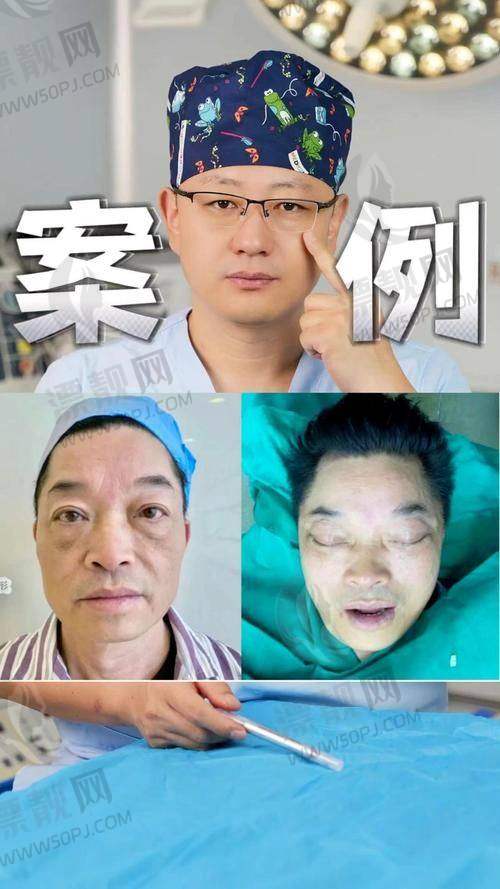 北京加减美医疗美容面部提升成效大揭秘