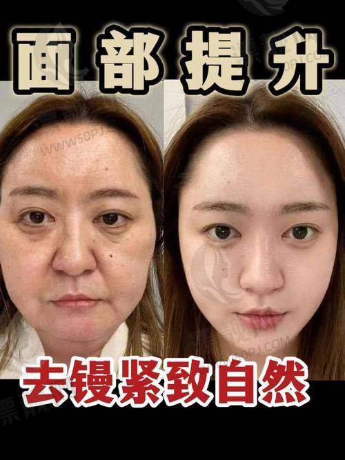 北京加减美医生团队：变得更美的“魔法师”