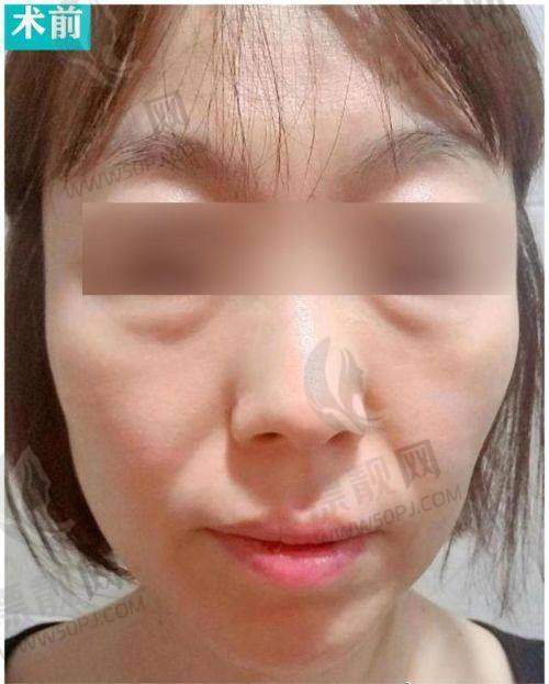 北京加减美医疗美容 v6 项目价格分析