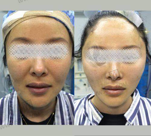 北京加减美医疗美容真的靠谱吗？正规性、v6价格及地址信息大揭秘！