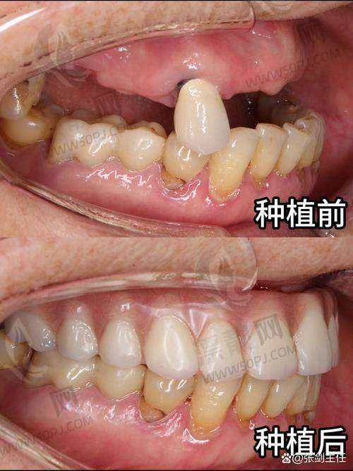 三、怎么预约？怕排不上的你一定要看→超全预约方式整合！