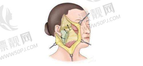 北京加减美医疗美容在几号出口出？了解其正规性、地址及面部提升效果，还有美容 v6 价格大揭秘！
