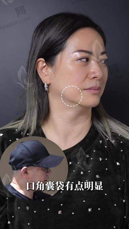 北京加减美医疗美容电话多少？想了解其正规性、地址及面部提升效果速看！