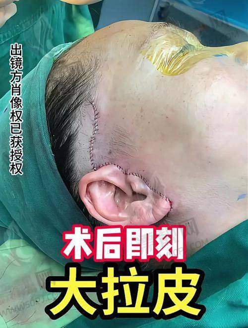北京加减美医疗美容的成功实例：实力见证美丽