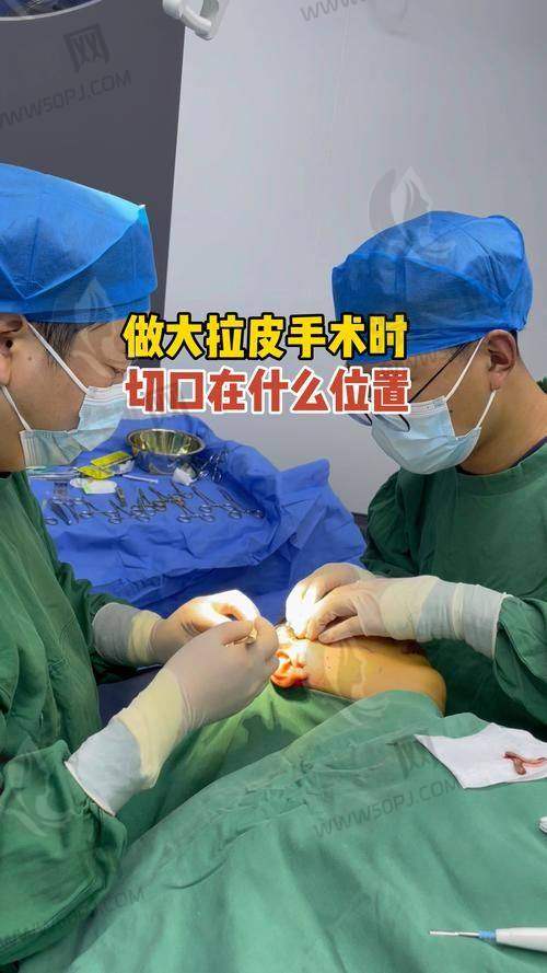 北京加减美医疗美容美容 v6 价格几何？