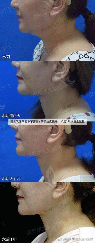 北京加减美医疗美容：是“莆田系”吗？